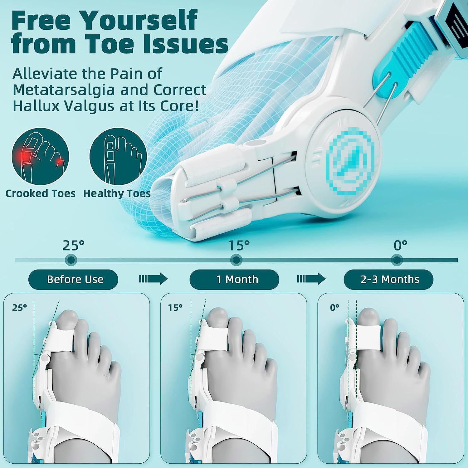 Adjustable Big Toe Valgus Corrector for Men and Women