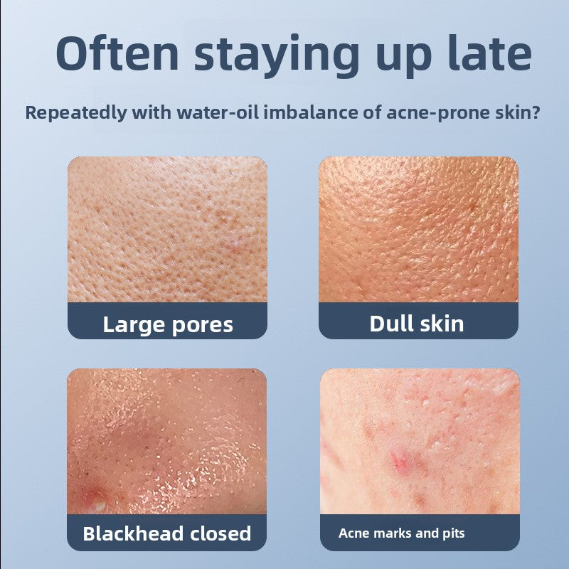 Salicylic acid rejuvenates, shrinks pores, cleanses and hydrates the face