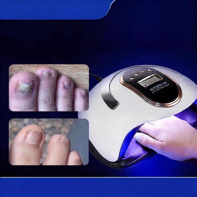 Blueque Smart Onychomycosis Phototherapy Machine