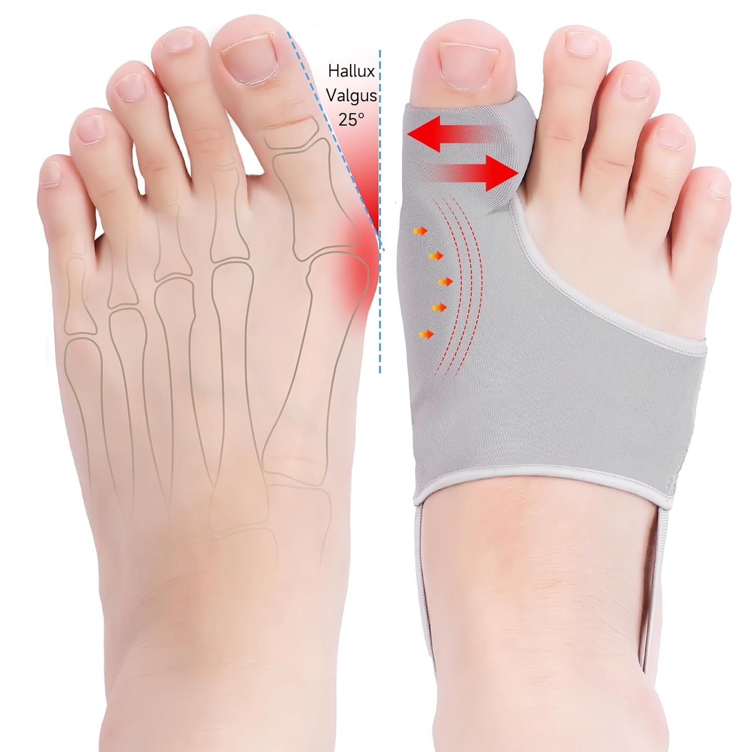 Toe Corrector for Thumb Valgus and Big Toe Painless Correction