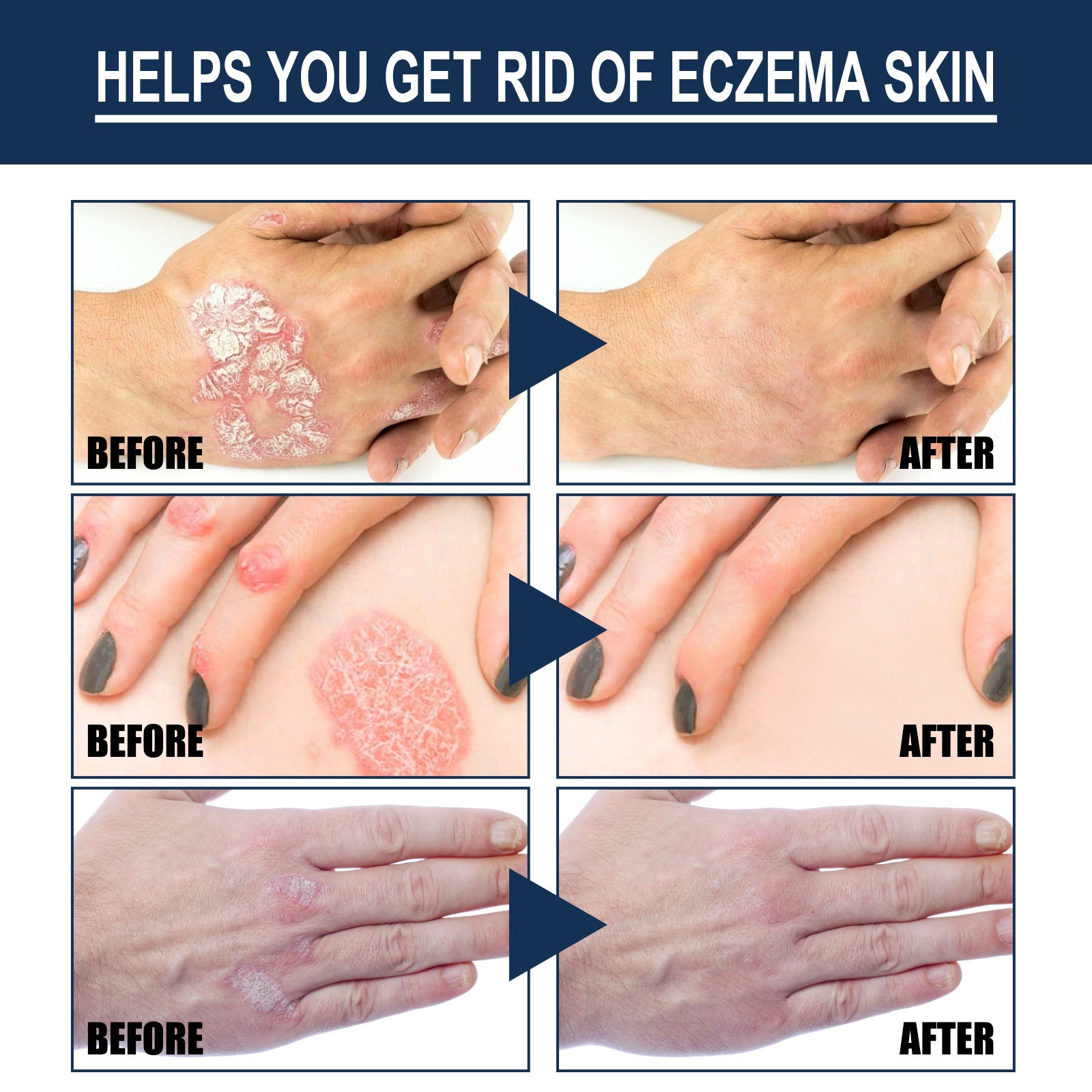 Skin care spray